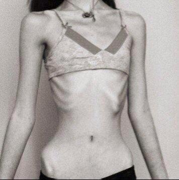 ED account. I tweet thinspo. This account is to express myself, please be warned that it may trigger. Not pro anything. -24 lbs overall