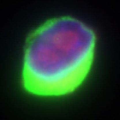 We study how micro-environmental and epigenetic mechanisms drive cancer cells into dormancy. We seek to control this biology to prevent metastasis.