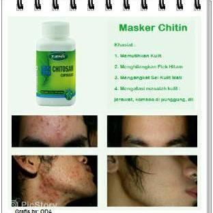 Jula Masker Chitin. Online / COD
PIN 56E24062 WA/SMS 089618199536
Line : Herbal_Online26