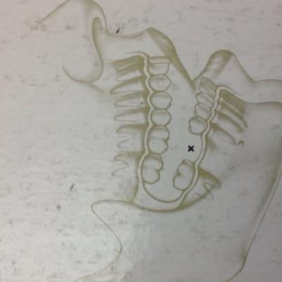 Education and Opinion Leader Manager, @DENTSPLYImplUk. All views are my own