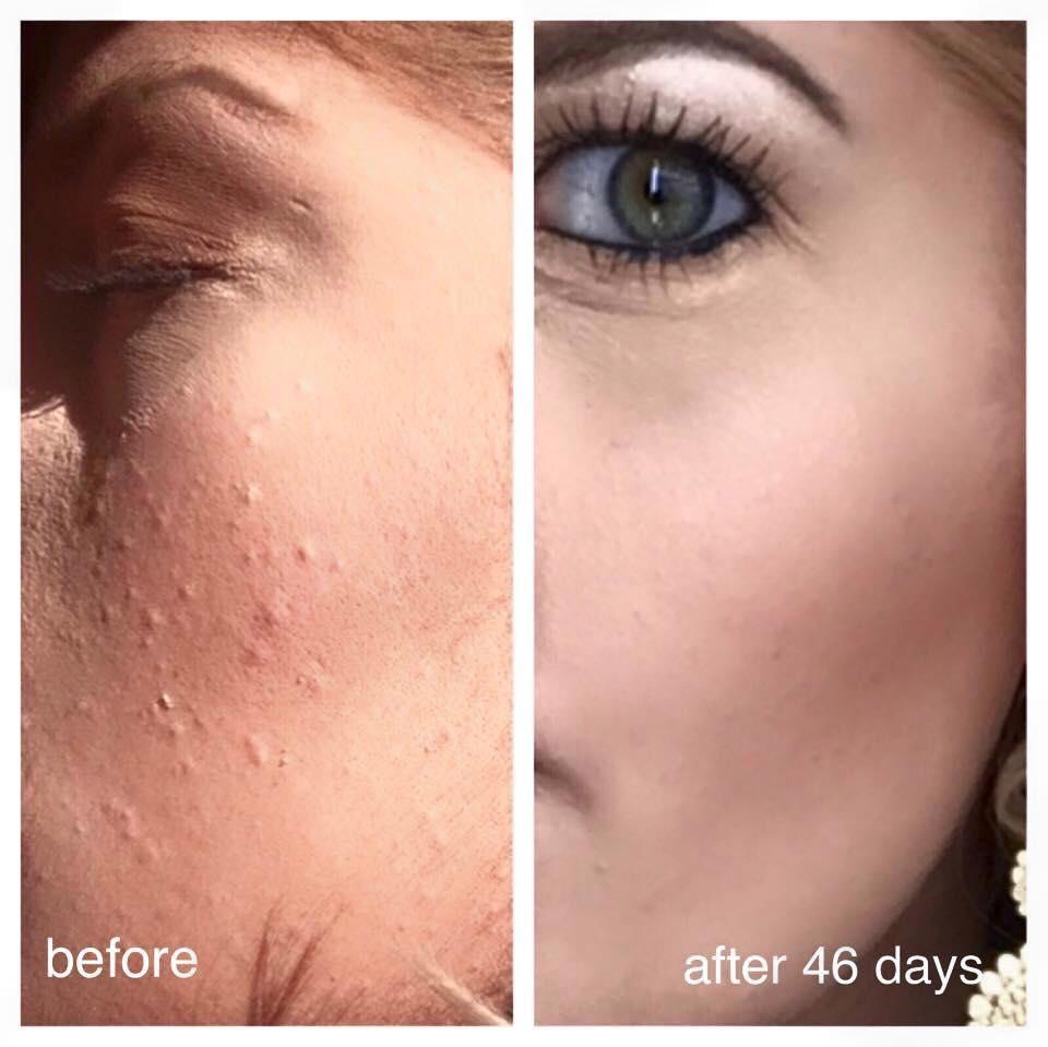 If they can do it - why can't I? Now it's YOUR time to shine! Look into Nerium today and change your skin and your life! *Free iPad *Free Lexus *Freedom