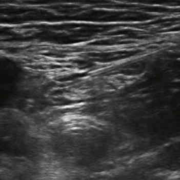 QRACanaesthesia's profile picture. Regional Anaesthesia