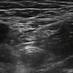 QRAC (@qracanaesthesia) Twitter profile photo QRAC (@qracanaesthesia) Twitter profile photo