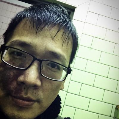 我是鐵蛋英雄