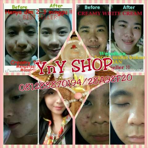 Yoeljelome's profile picture. Beauty skin care 100% racikan dokter n 100% asli terbukti banyak testimony cewe dan cowo , welcome reseller n droshiper ☺,cp: 081288870194/pin: 28A98F20