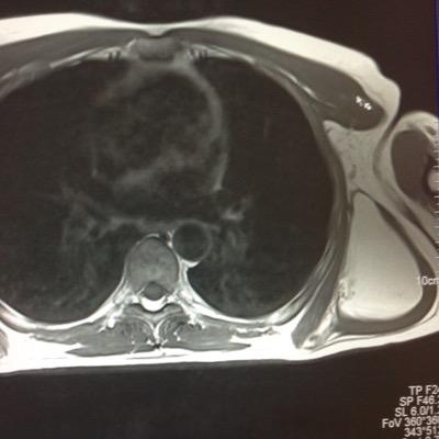 GraemeStrong's profile picture. Rock music (Sabbath, Purple, Rush, Rammstein) and running (from 5k - Marathon). Professionally: Radiographer (split between managing, clinical and MR reporting)