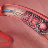 Stroke Trials(@StrokeCliTrials) 's Twitter Profile Photo