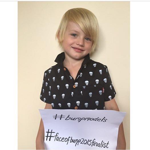 vote for baylee instagram bumpmodels #faceofbump2015finalist
