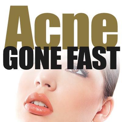 Check out the latest Acne news on the web!