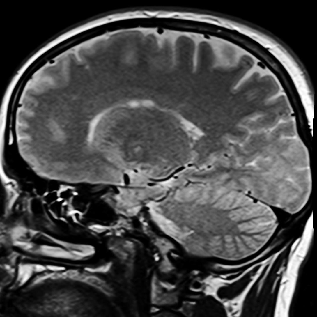Fast Medicine Facts to stimulate your curiosity - Approved by Medical Staff -Medicine in 30 seconds