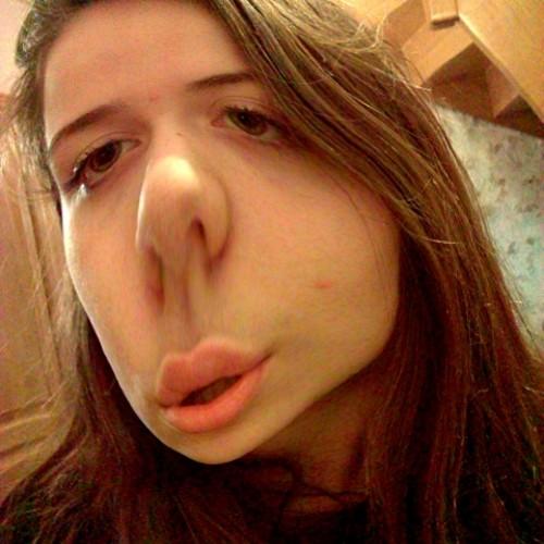 MDR PD