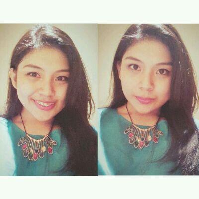 Airlangga University