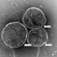 ureaplasma lab (@ureaplasmalab) 's Twitter Profile Photo ureaplasma lab (@ureaplasmalab) 's Twitter Profile Photo