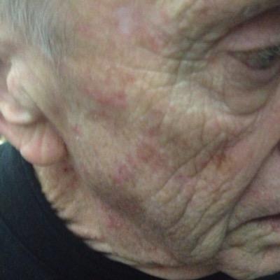 Hospice is shortening the lives of our Elders. Board and Care Facilities and Skilled Nursing facilities plz check them before. STOP CHEMICAL RESTRAINTS !