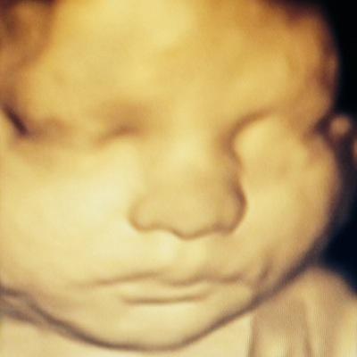 3DMaternity's profile picture. Experience Love at first sight at 3D Maternity Imaging! See whose unique features your baby will posses!