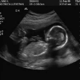 Unborn little baby. Loving my mommy since day 1. {RP}