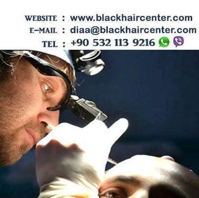 ‏زراعة الشعر في تركيا باحدث التقنيات والأجهزة الحديثة وبعروض مغرية...