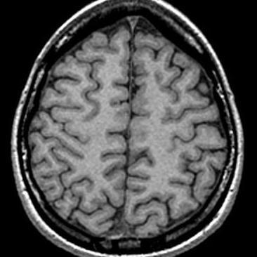 perceptrondata's profile picture. Artificial Intelligence. Genuine insight. 
We use machine learning, artificial intelligence and data science to generate actionable insights for your business.