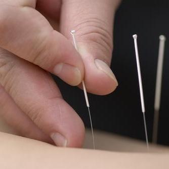 ACUPLUS_eshop's profile picture. https://t.co/ZQRpXDpJPo
Acupuncture consumables
Athens, Greece