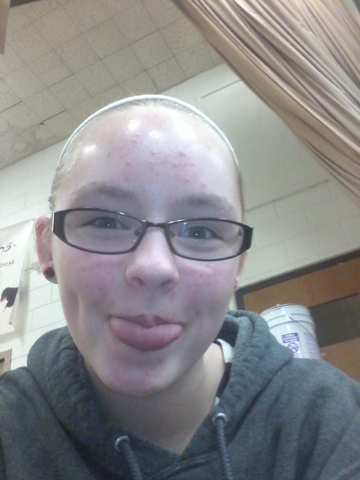 single