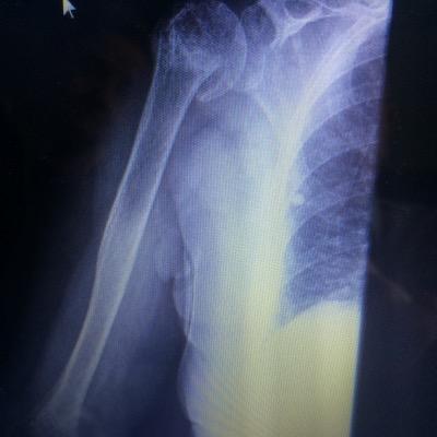 medico traumatologo