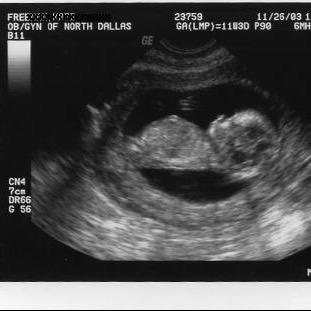 BabyJnrBrooksx's profile picture. Unborn baby. Mommy: @HeidiMayBear Daddy: @TwinJaiBrooks_