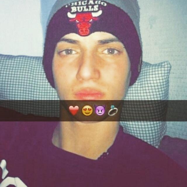 AG