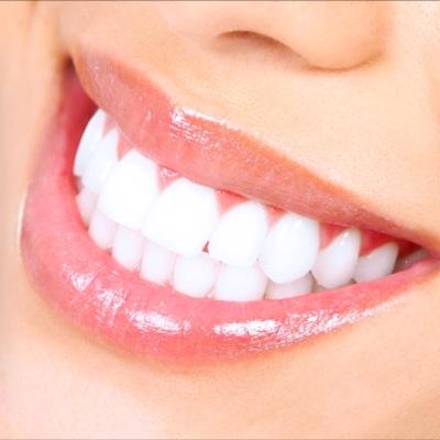 Professional teeth whitening technician! email: Smilewhiteteeth@hotmail.com

 If interested then please message us for contact details, or simply just email us!