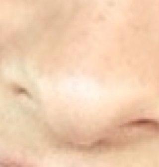 location: in between her eyes