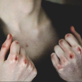 it does hurt seeing beauty in everyone else but yourself.