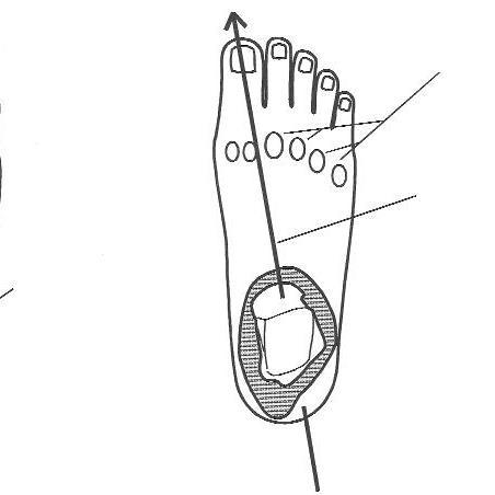 Observador de los pies, aprendiendo de pies y tratando de tratar pies.
Sports podiatrist,Football and Running injury prevention.
Lower limb Biomechanic.