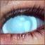 #metall