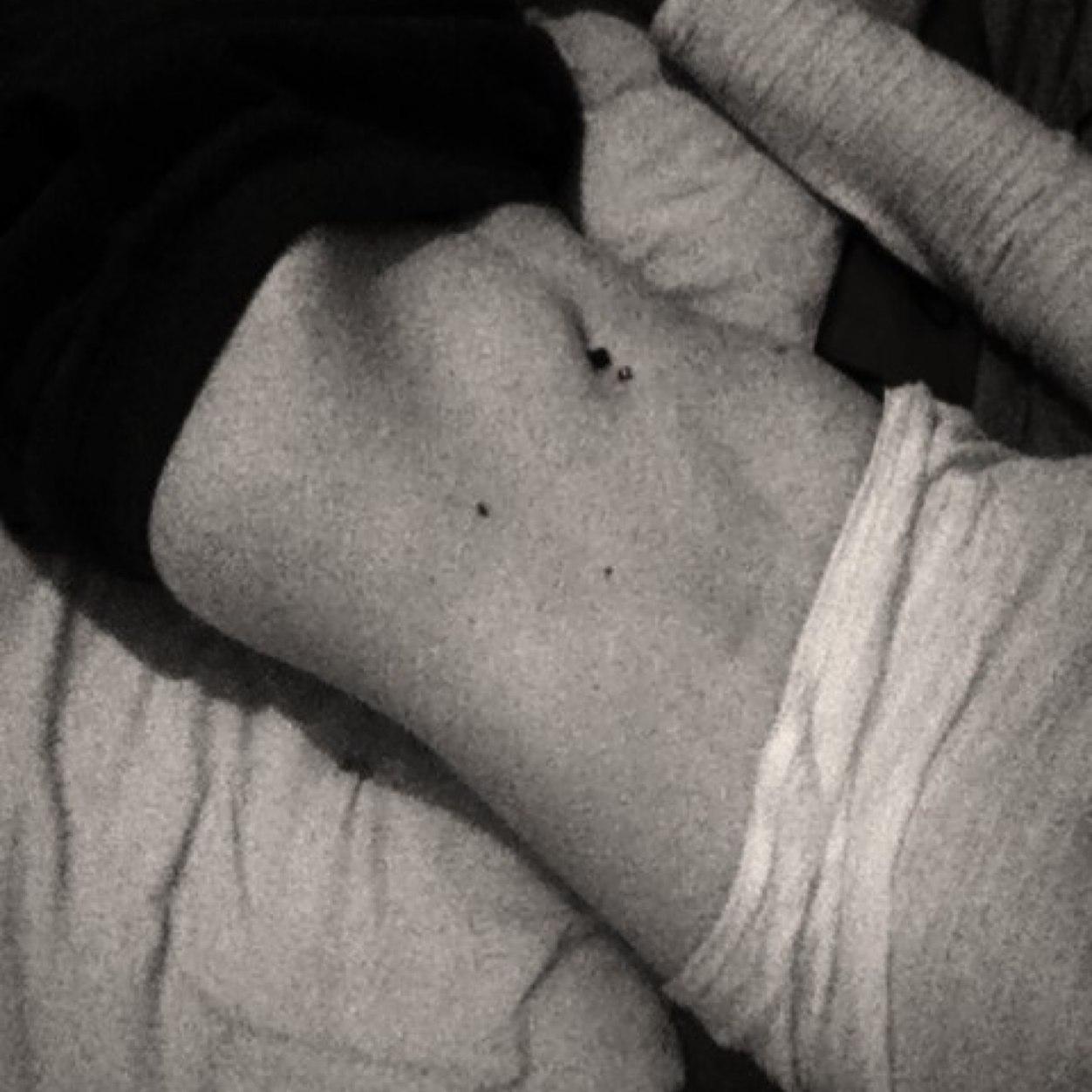 anorexic, self harmer