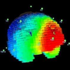 Neurofeedbacktherapeut, BCIA BCN und Instructor
Ich bin Ergotherapeut in München und leite dort das Institut für EEG-Neurofeedback.