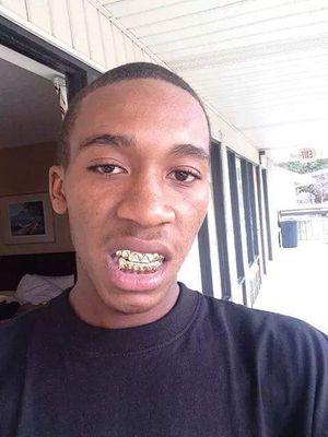 Pull Up Game Stoopid #ABK #30ClipShawty