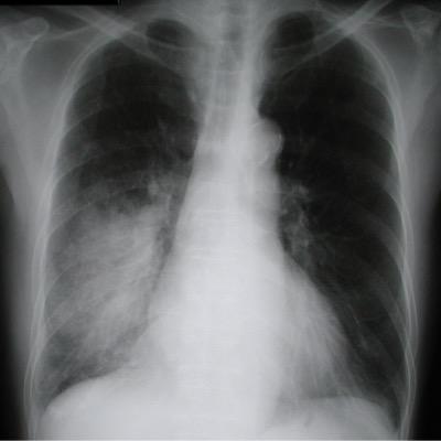 med_zebra's profile picture. Aut viam inveniam aut faciam