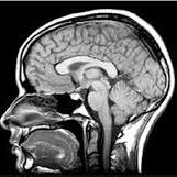 Clínica de Imagem Alvorada - Ressonância Magnética - Tomografia Computadorizada