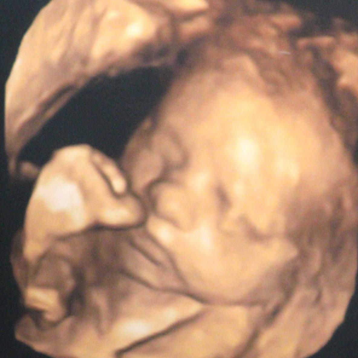 BabyFace4D's profile picture. Advanced Ultrasound Practitioner providing, professional ultrasound services across Worcestershire and South Midlands.