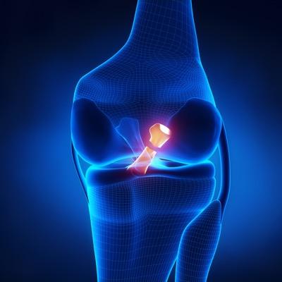 ACL Recovery Club Profile