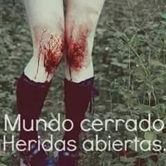 || Muerta en vida || Solo quiero amar a alguien que me ame a mi || 13 años || Bipolar || Deb, Cat, Mia, Ana, Olive, Perry, Annie, Sue ||
