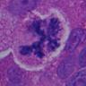 PathoPictures's profile picture. Casual account to share great photos from everyday pathology practice.