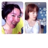 ฉันสิวหาย+ผอมลง (@pangsutthida) 's Twitter Profile