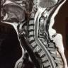 spineopine's profile picture. Opining on Spine Surgery and Stuff.