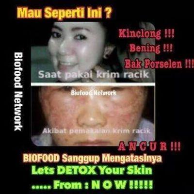 anindyadariyana's profile picture. BIOFOOD | pin: 7DD27B12 | Line: anindyaariyana | supplement kesehatan & kecantikan dgn sertifikasi GMP,ISO,FDA,HALAL,MUI,HACCP,POM-RI,DGNED,APINDO,GAPMMI,KADIN