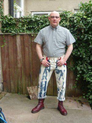 international Skinhead of mystery.