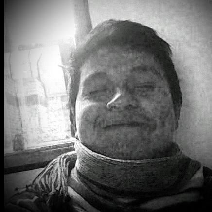 renzoino's profile picture. UNMSM- MEDICINA VETERINARIA