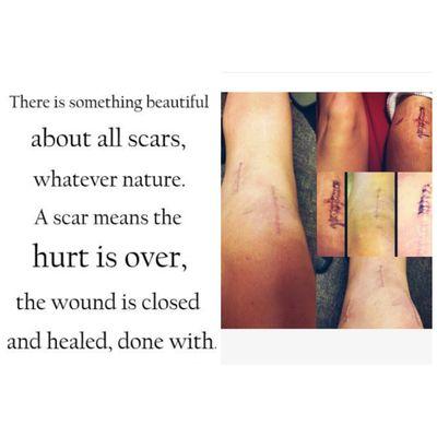 dedicatedfittie's profile picture. Distributor of Advocare. Please ask any questions regarding these AMAZING products. P.S. Avi is me. 3 knee surgeries in 3 yrs. NEVER give up. #FitFam #Forever