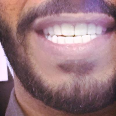 غلآگ ف قلبي يبطي يهزه عاذل من مگآنہ ♡”_