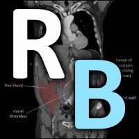 Radiology Basics (@basicradiology) 's Twitter Profile