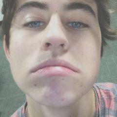 lol ur not nash